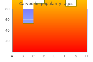 buy carvedilol no prescription